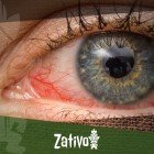 Red Eyes And Cannabis: Why, And What To Do About It